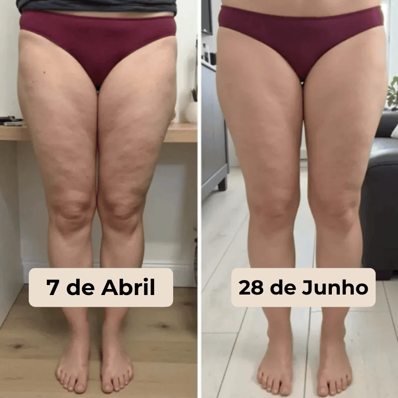 Celulivre Legging 3D – Redefina sua silhueta sem esforço